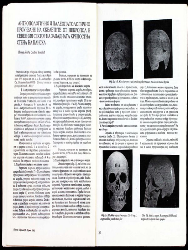 Антропологично и палеопатологично проучване на скелетите от некропол в северния сектор на западната крепостна стена в Плиска