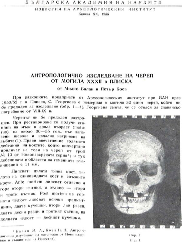 Антропологично изследване на череп от могила XXXII в Плиска
