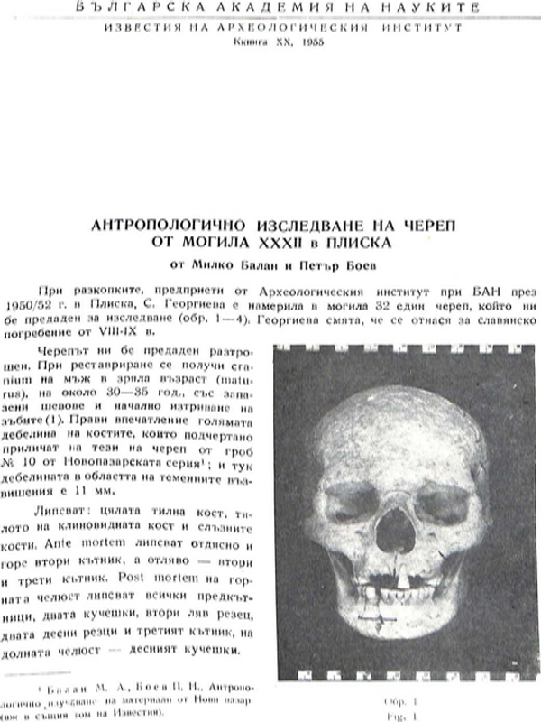 Антропологично изследване на череп от могила XXXII в Плиска